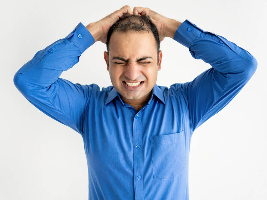 homem com calvície causada pelo estresse