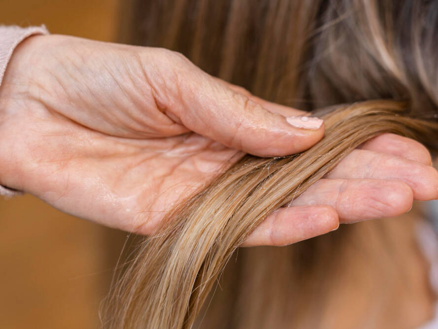 angulação dos fios