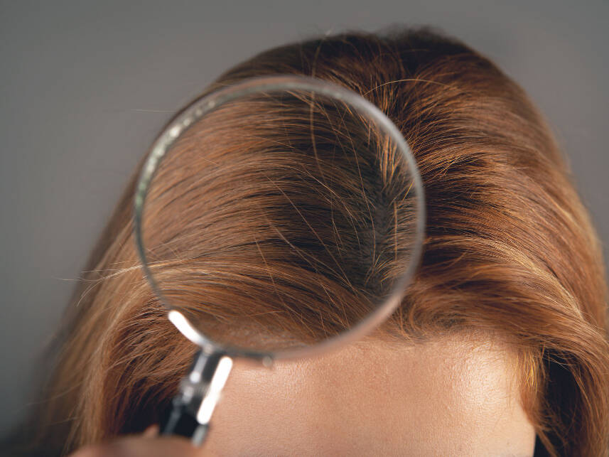 densidade capilar ideal