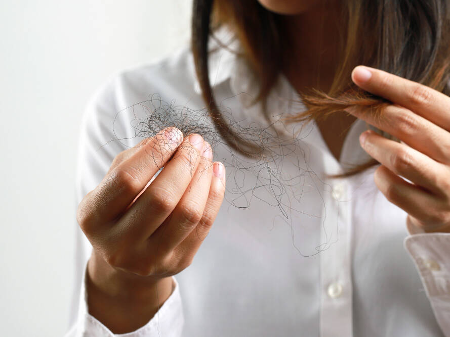 mulher com queda de cabelo