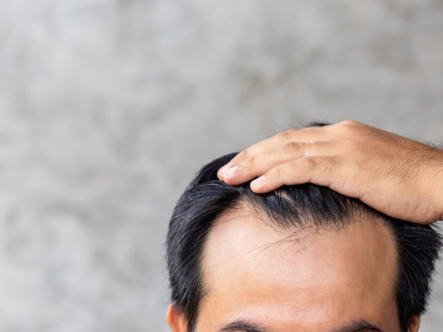 linha frontal masculina