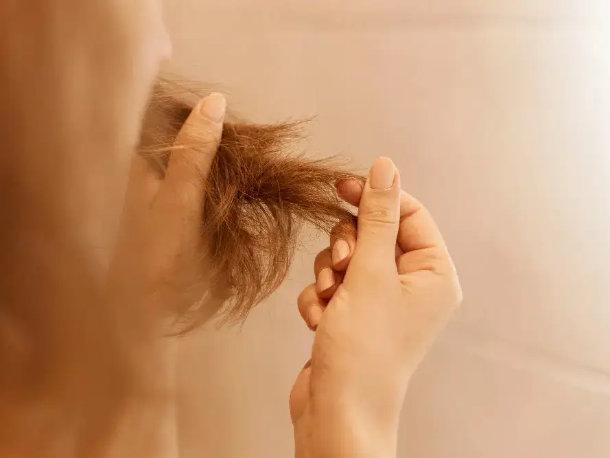 O que causa a queda de cabelo