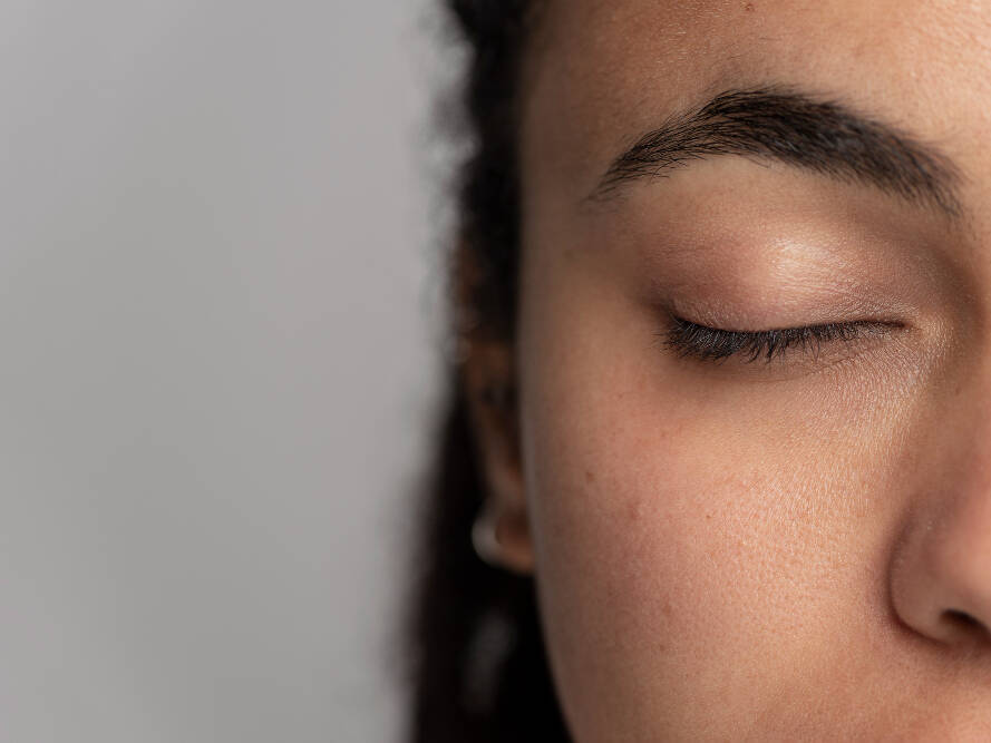 falhas na sobrancelha