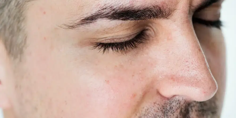 É normal os pelos da sobrancelha caírem