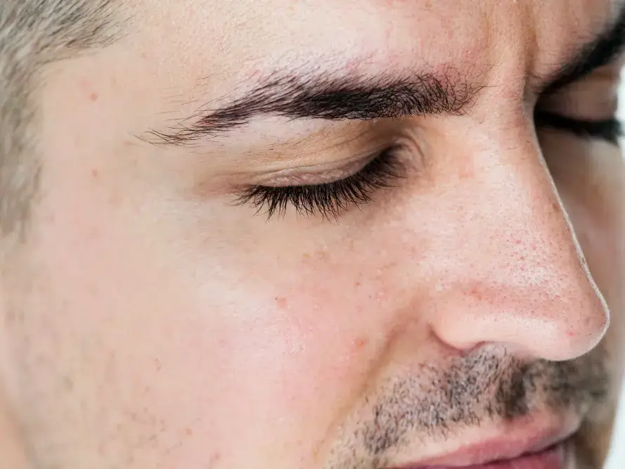 É normal os pelos da sobrancelha caírem