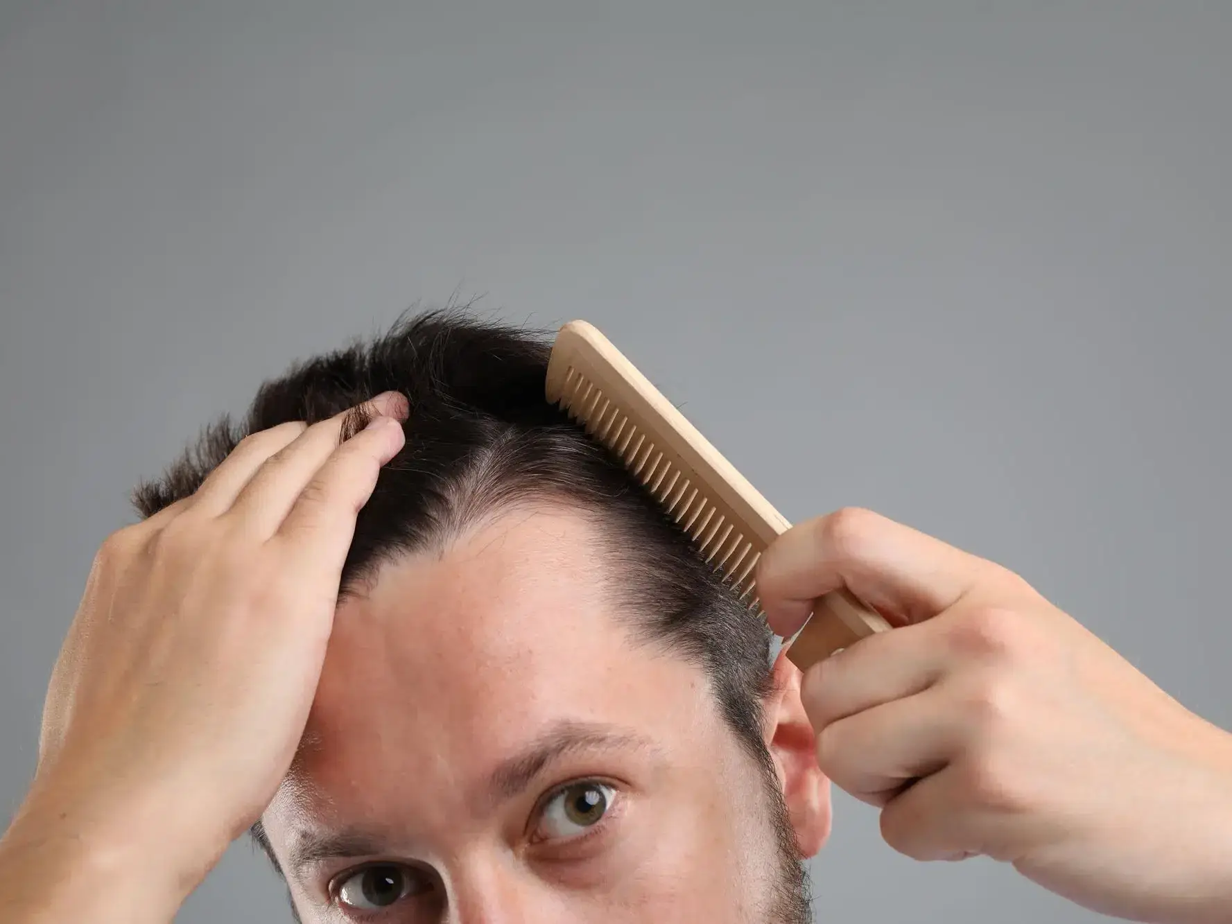 homem penteando o cabelo e causando alopecia por tração