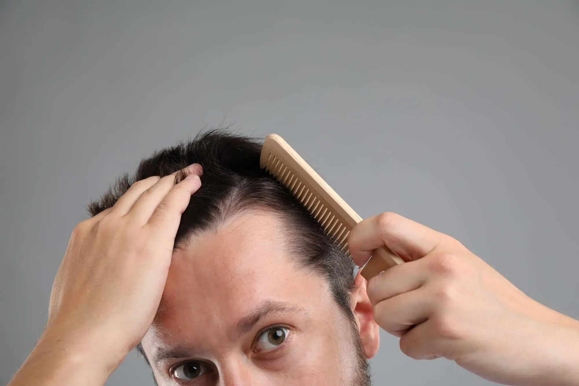 homem penteando o cabelo e causando alopecia por tração