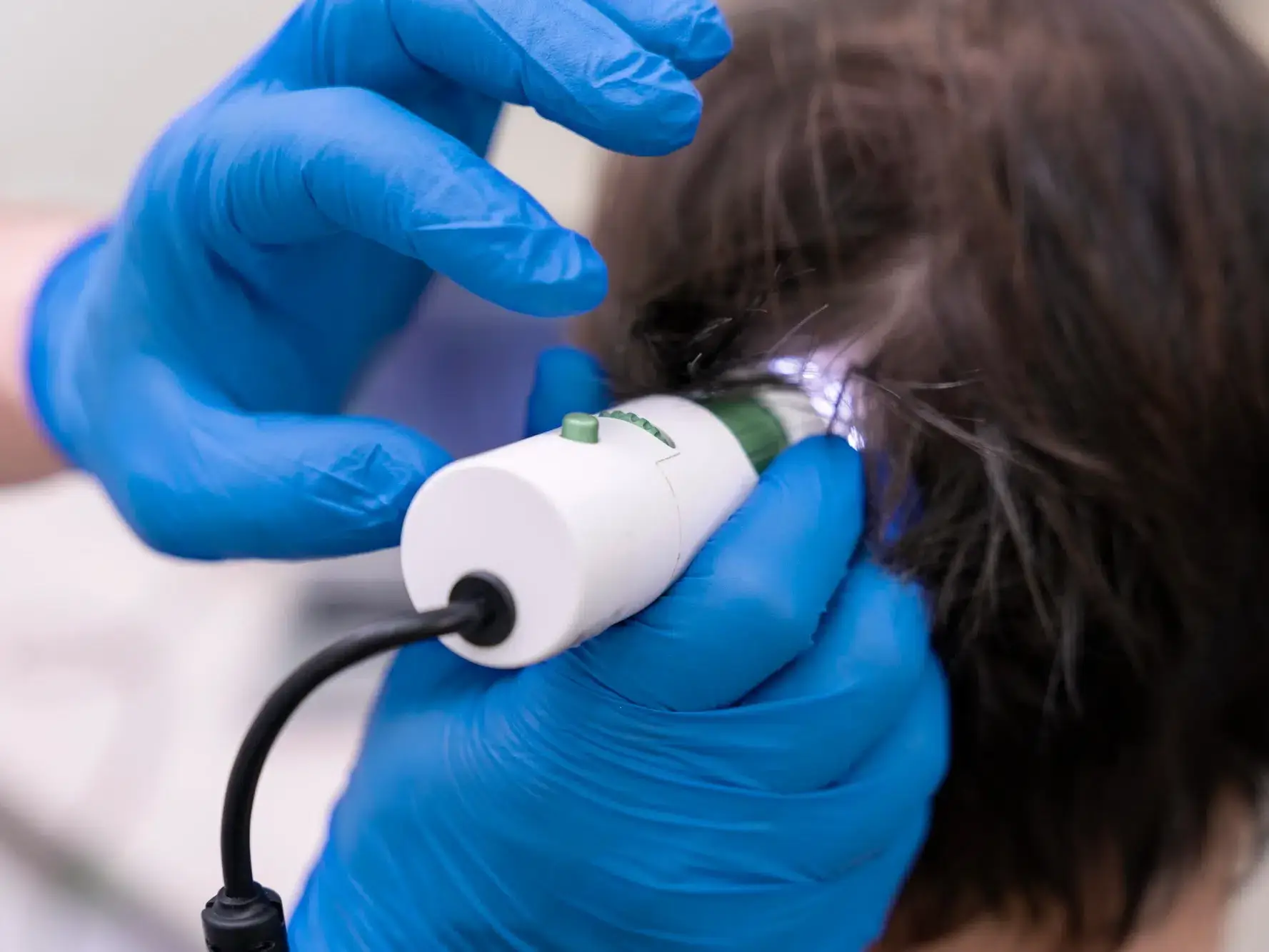 homem fazendo procedimento de laser capilar para queda de cabelo