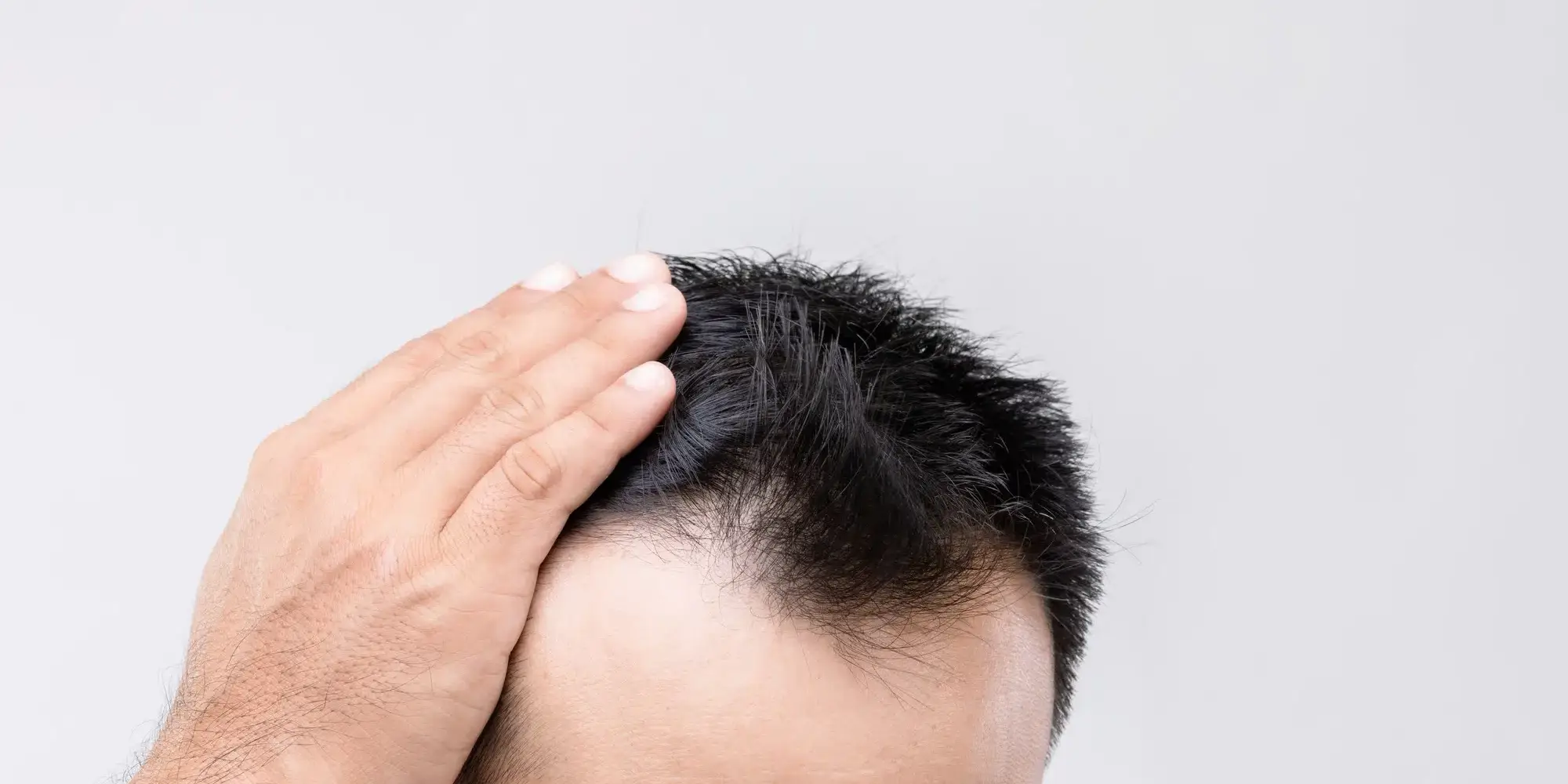 entradas no cabelo