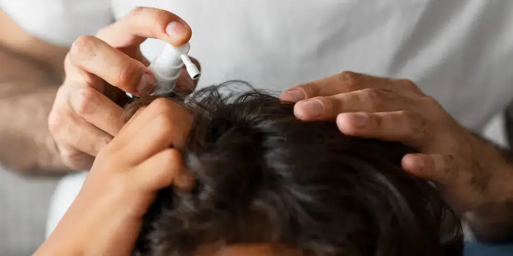 homem usando minoxidil oral para queda de cabelo