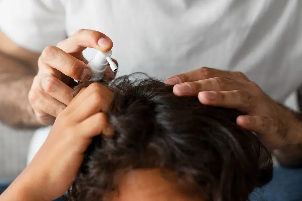 homem usando minoxidil oral para queda de cabelo