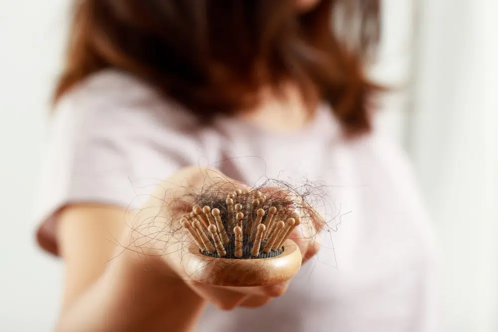 mulher com anemia e queda de cabelo